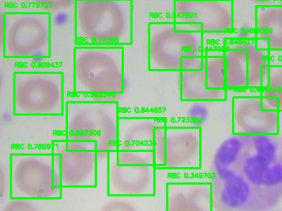 Deep Learning From The Trenches Object Detection Using Deep Learning